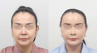 Slider image (1) AB Plastic Surgery
